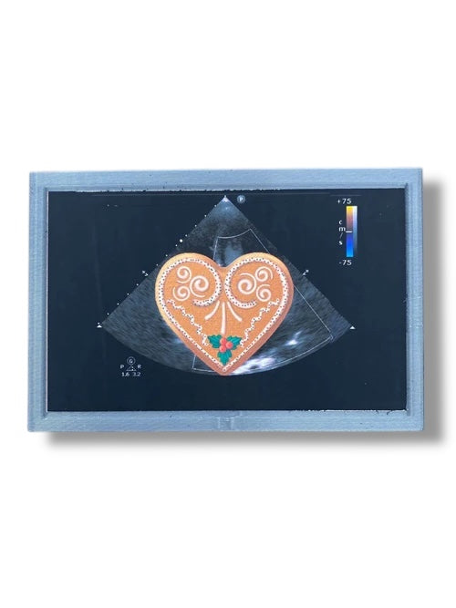 Mini Echocardiogram / Ultrasound Play Tool