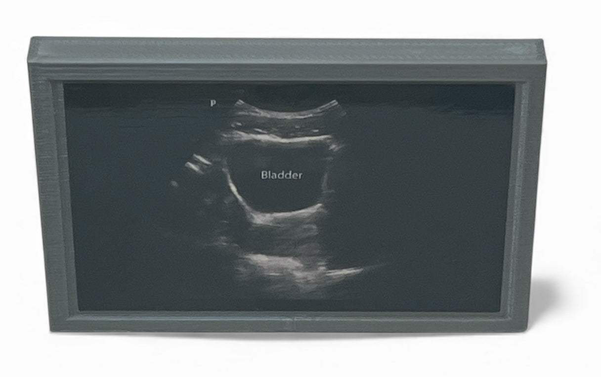 Mini Echocardiogram / Ultrasound Play Tool