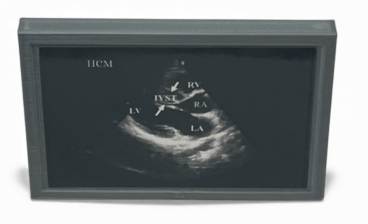Mini Echocardiogram / Ultrasound Play Tool