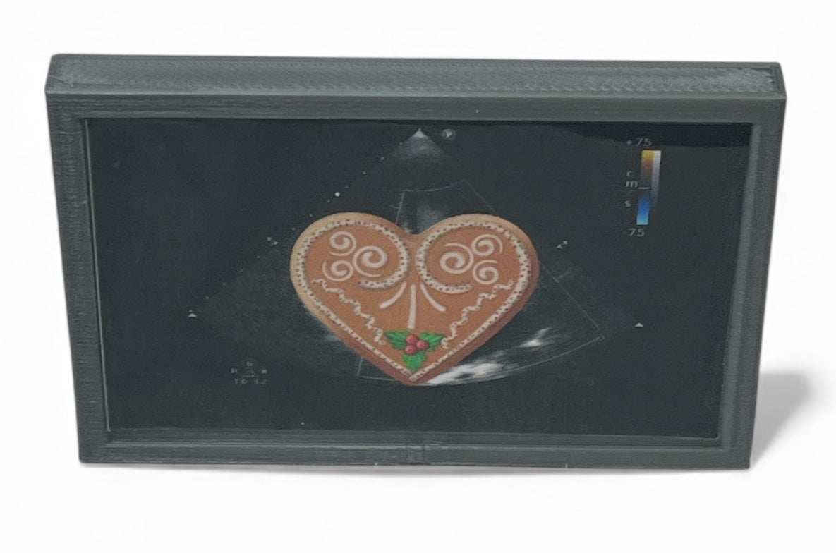 Mini Echocardiogram / Ultrasound Play Tool