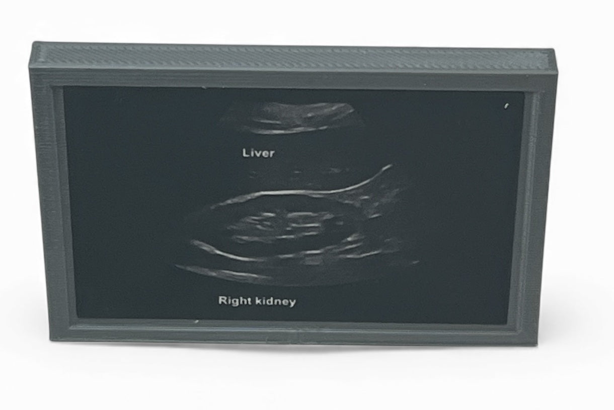Mini Echocardiogram / Ultrasound Play Tool