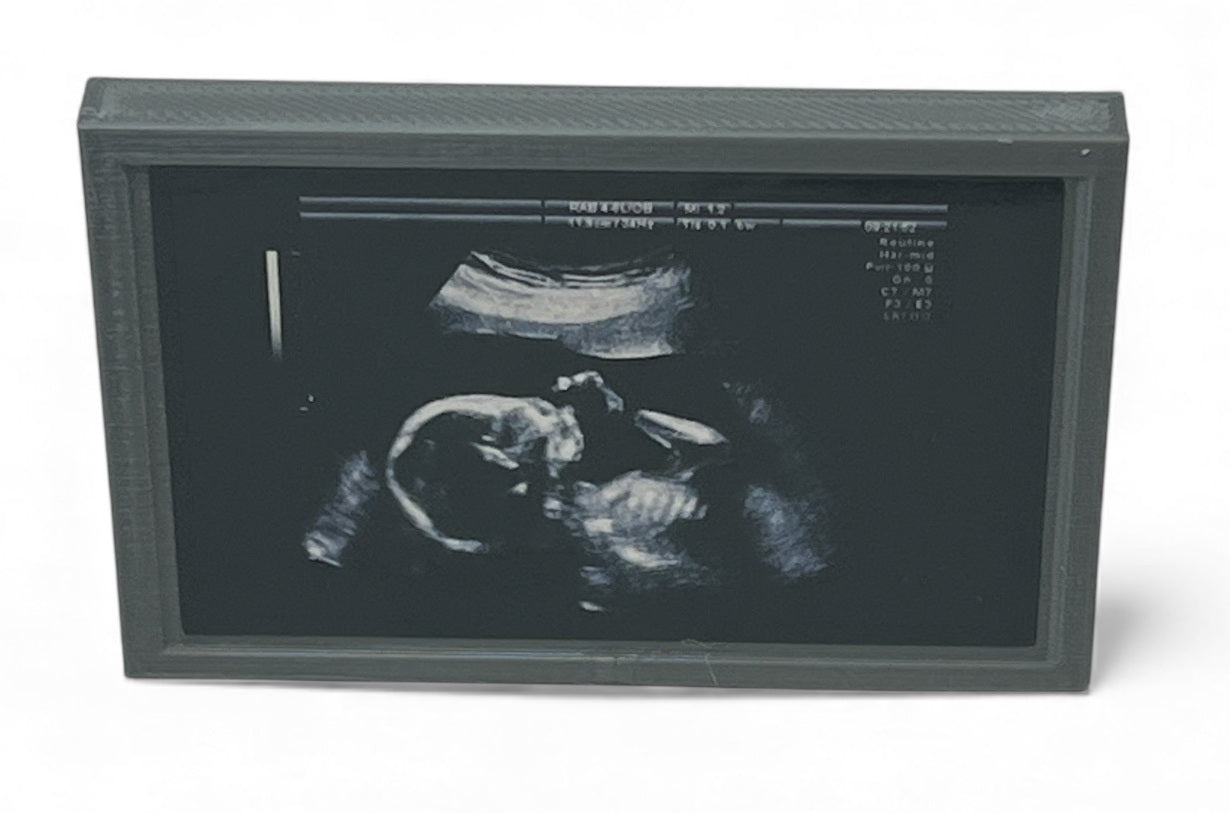 Mini Echocardiogram / Ultrasound Play Tool